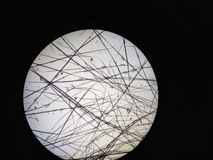 螨虫虫卵 1.jpg